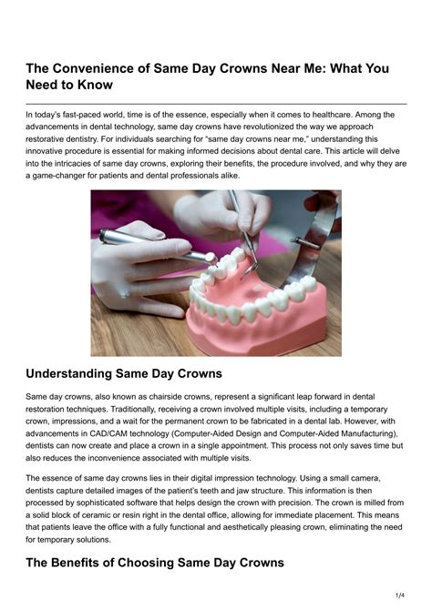 PPT - The Convenience of Same Day Crowns Near Me What You Need to Know PowerPoint Presentation ...
