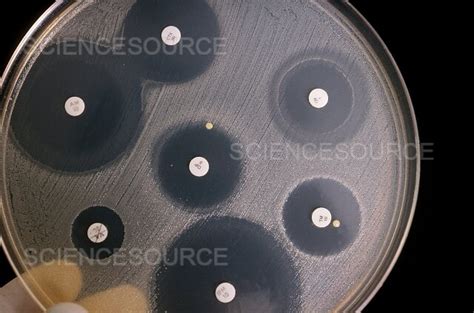 Image result for Disk Diffusion Method Interpretation