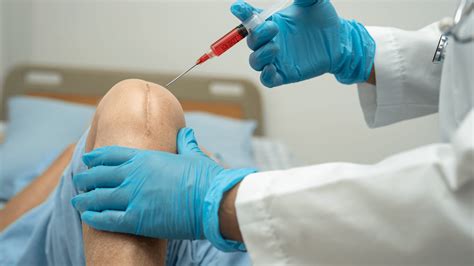 Stem Cell Injection 的图像结果