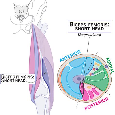 Gross Anatomy Glossary: Biceps femoris (short head) (of hamstrings ...