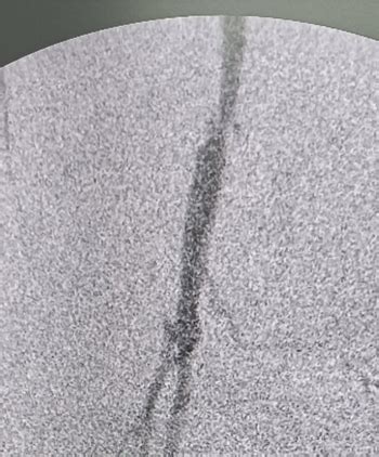 Dr. Rajesh, Vascular Surgeon - Vascular & Endovascular Surgery
