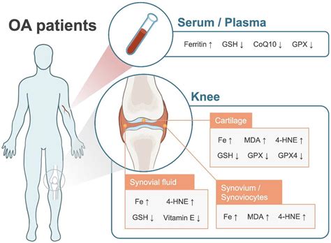 The Role Played by Ferroptosis in Osteoarthritis: Evidence Based on Iron Dyshomeostasis and ...