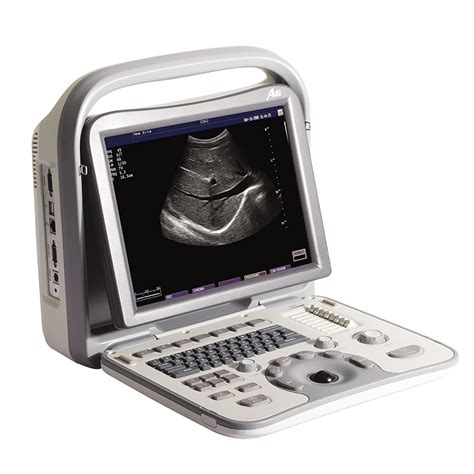 Ultrasound Scan Machine 的图像结果