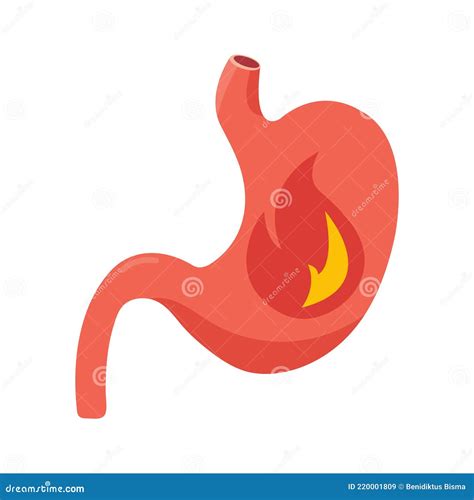 Illustration of Stomach Burning Sensation Stock Vector - Illustration of science, irritation ...