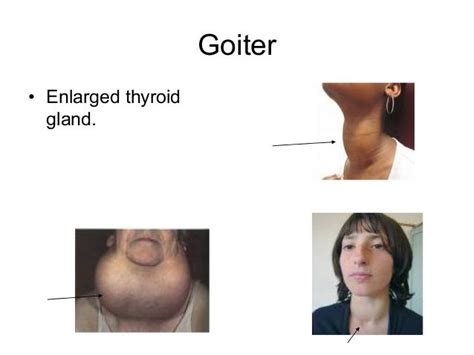 Image result for Thyroid Function Algorithm