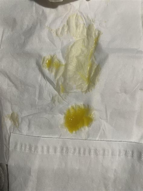 In the last ten minutes my snot has turned neon yellow : r/medical_advice