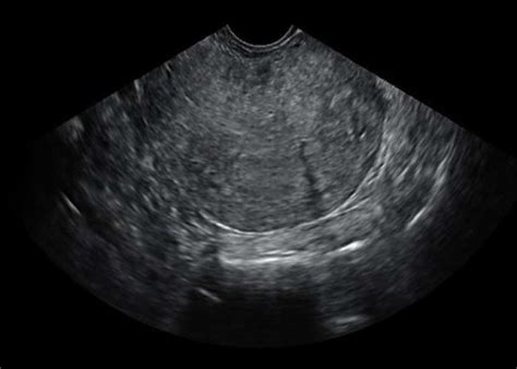Dr. IJCP Editorial Team | Medtalks
