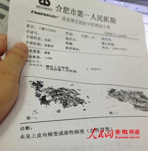 单江县第一人民医院病历(5张)图片 - 我要证明网