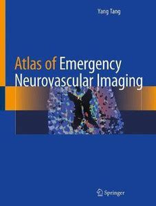 Atlas of Emergency Neurovascular Imaging: Buy Atlas of Emergency ...