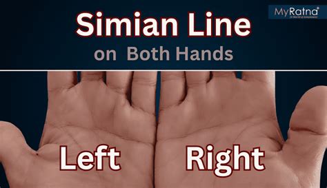 Simian Line: Meaning, Personality, Remedies, and Diseases Linked to th