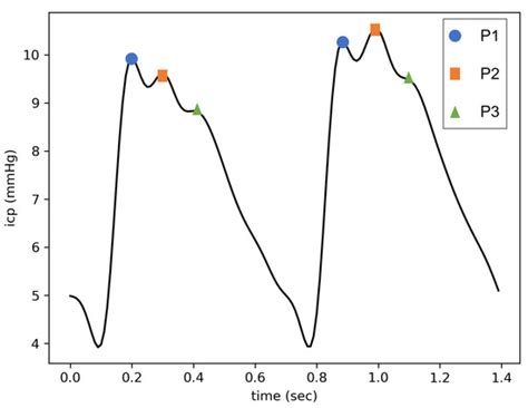 A Deep Learning-Based Automated Framework for Subpeak Designation on ...