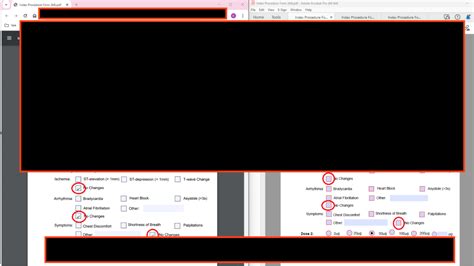 Image result for Checkbox Values