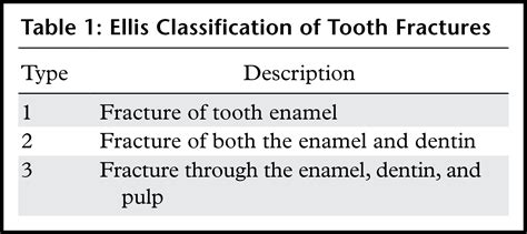 Image result for Graphical Abstract Examples of a Process