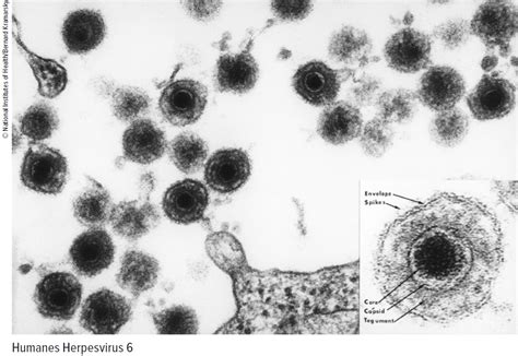ICU: Kontroversen in der Infektiologie - Infektiologie - Universimed ...