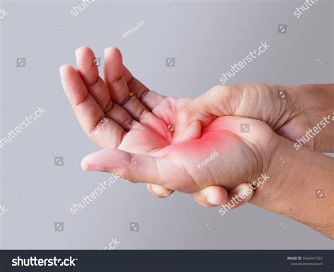 Hand Pain On Palm