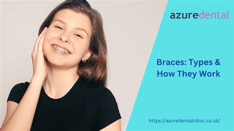 Dental Braces: Types & How They Work - Azure Dental Clinic