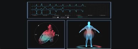 Coronary Angiogram Procedure 的图像结果