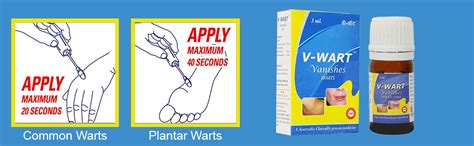 Buy V-Wart Remover Liquid Rapidly Eliminates Both Plantar and Common ...