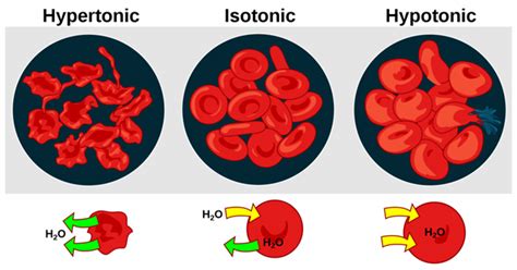 Types of IV Fluids 的图像结果