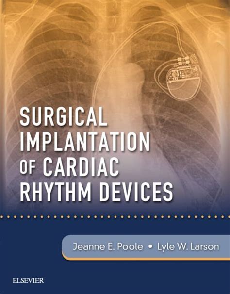 Surgical Implantation of Cardiac Rhythm Devices: 1st edition | Jeanne ...