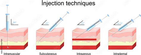 Image result for Subcutaneous vs Intradermal Mouse Injection