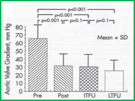 Image result for Maximal Instantaneous Gradient