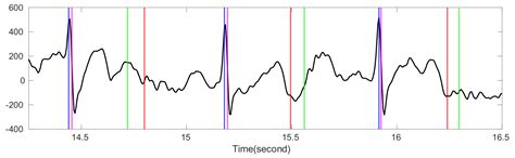 Robust T-End Detection via T-End Signal Quality Index and Optimal Shrinkage
