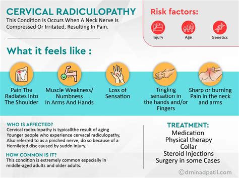 Treatment For Radiculopathy