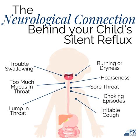 What is Silent Reflux in Children? | PX Docs