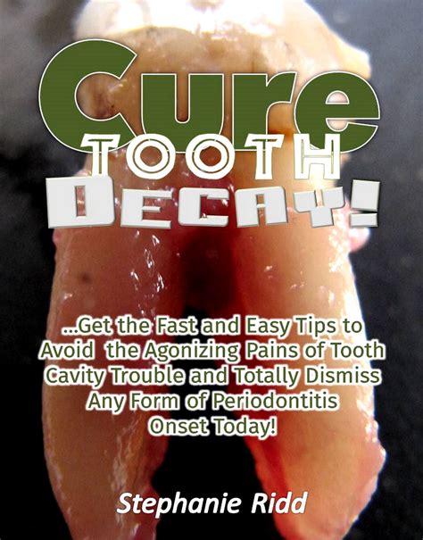 Buy Cure Tooth Decay!: Get the Fast and Easy Tips to Avoid the ...