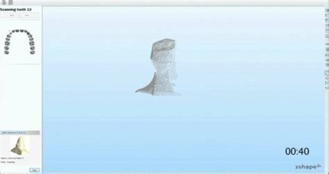 Image result for 3Shape Design Software