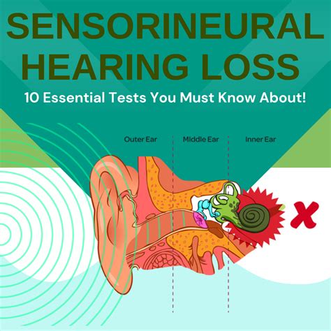 Sensorineural Hearing Loss Diagnosis: 10 Essential Tests You Must Know About! | Sphere Speech ...