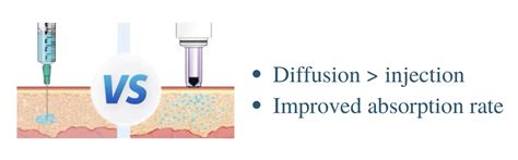 Image result for Spring Based Non-Invasive Injection