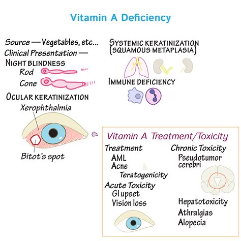 Vitamin A Deficiency Diseases Understanding Health Conditions Linked