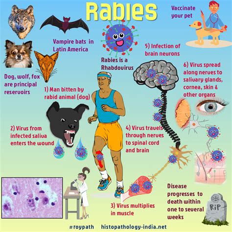 Pathology of Rabies | Animal bites, Pathology, Animal disease