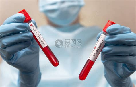 渭南血站检验科开展生物安全应急演练-中国输血协会