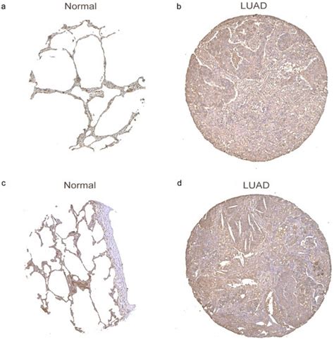 Identification of m7G-Related miRNA Signatures Associated with ...
