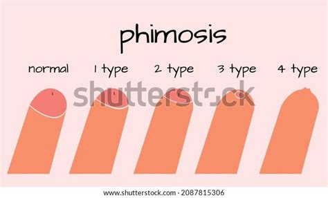 Image result for Simbol Lab API