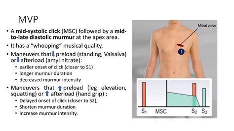 Cardiac Murmur & Dynamic Auscultation.pptx