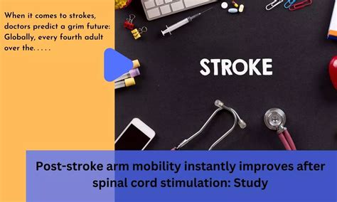 Post-stroke arm mobility instantly improves after spinal cord ...