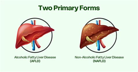 Bloating, Acidity & Weak Digestion? It Could Be a Sign of fatty Liver ...