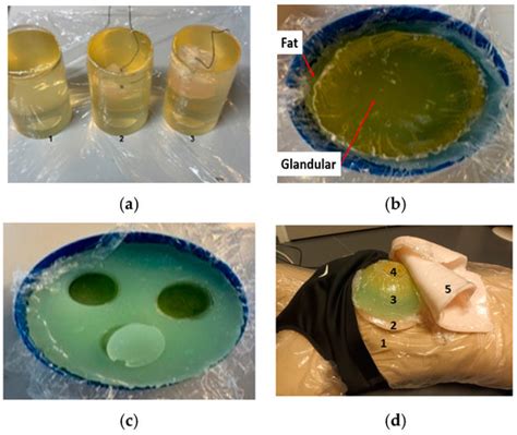 A Breast Tumor Monitoring Vest with Flexible UWB Antennas—A Proof-of ...