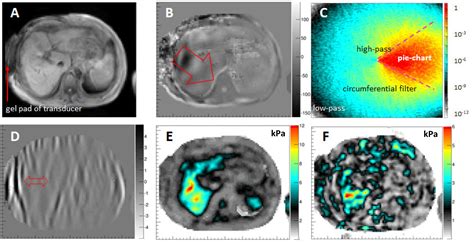 MR Elastography Using the Gravitational Transducer