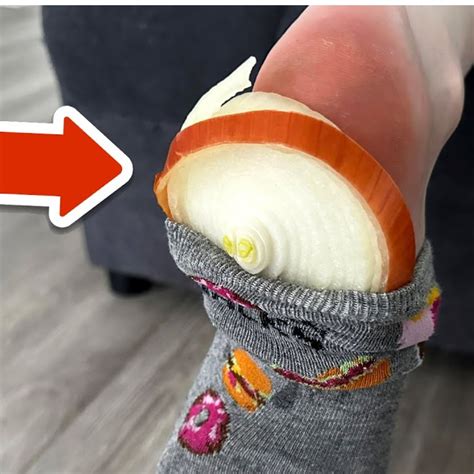 Onion On Socks