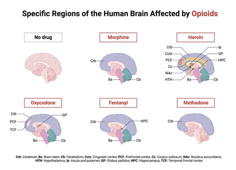 Specific Regions of the Human Brain Affected by Opioids | BioRender Science Templates