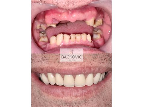 BACKOVIC DENTAL MEDICINE | Dental surgery | 1a Gospodara Vucica st ...