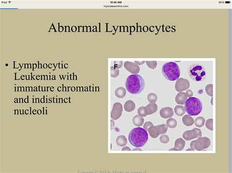 What Is A Standard Range For Lymphocytes at Logan Kemp blog