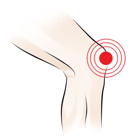 Orthotics Inserts For Shoes & Orthotic Insoles | Footlogics India