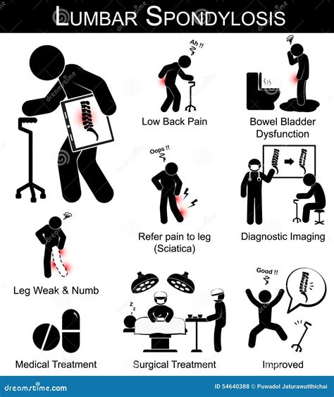 Lumbar Spondylosis Symptoms Pictogram Stock Vector - Illustration: 54640388