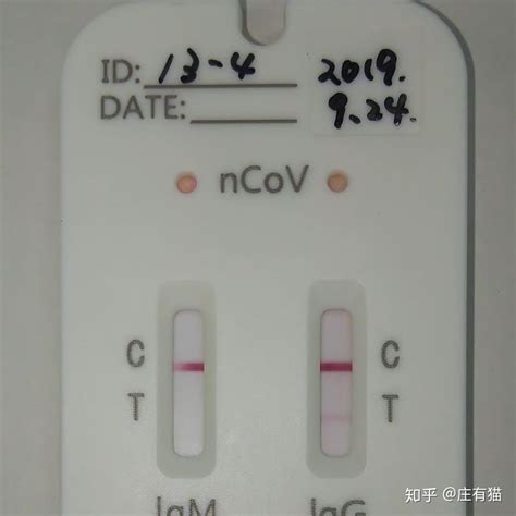 【疫情笔记】日本去年9月的血清样本，发现了新冠抗体阳性…… - 知乎